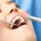 Dental-Implant-Profession