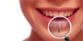 After Dental Implants- Home Care Instruction