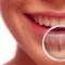 Dental-Implants