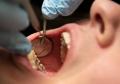 How to Overcome Dental Anxiety and Fear