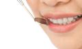 Enhancing Smiles  Exploring Cosmetic Dentistry Treatments