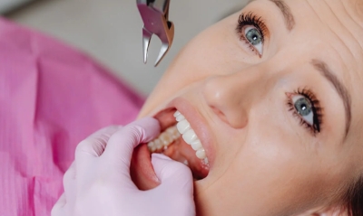 Wisdom Tooth