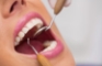 Understanding the Roles of an Emergency Dentist