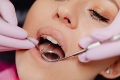 Is Wisdom Teeth Removal Really Necessary Weighing the Pros and Cons
