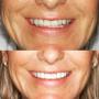 dentist north ryde