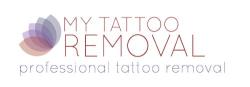 My Tattoo Removal