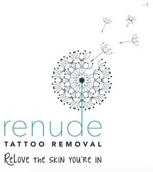 Renude Laser Tattoo Removal