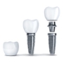 Dental implants sydney