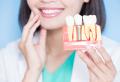 How Dental Implants Can Transform Your Smile and Boost Your Confidence