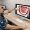 Dental-Implants