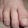 Procare Podiatric Medicine & Surgery