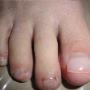 Procare Podiatric Medicine & Surgery