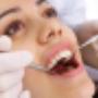 Teeth extraction