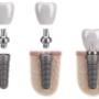 Oxford Street Dental