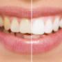 Oxford Street Dental