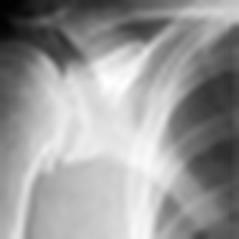 Dr Warren Kuo Orthopaedic Surgeon
