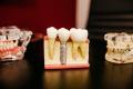 The Popularity of Invisible Braces in Melbourne Today