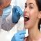 Wisdom-Teeth-Removal