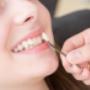 Dental Veneers Melbourne
