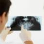 X-Ray