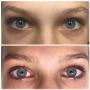 Eyelash Lifting