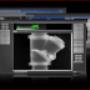 Uploaded by visitor on 13/12/2017 - Digital Radiography