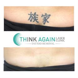 think again laser clinic