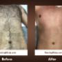 Mens waxing at waxing Ninja: Before and After