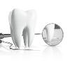 Dental Bridges