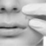 Hair Removal Sydney