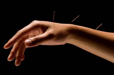 BENEFITS-OF-ACUPUNCTURE