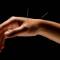 BENEFITS-OF-ACUPUNCTURE