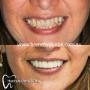 Hornsby cosmetic dentistry