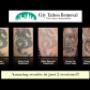 Tattoo Removal Brisbane Fade-back for Coverup
