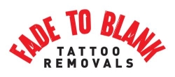Fade to Blank Tattoo Removals