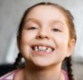 Orthodontics for Children
