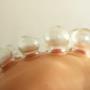 Cupping