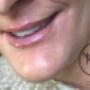 Uploaded by visitor on 1/9/2017 - Lip Liner Tattooing