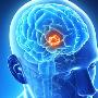 Brain Tumour Surgeon