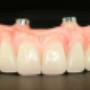 Dentures Plus