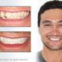 Cosmetic Dentist Mt Lawley1
