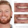 Mt Lawley Teeth Whitening