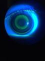 Myopia Control