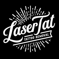 LaserTat