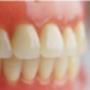 Dentures