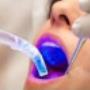 Fillings