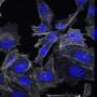 Prostate Cancer - Cells