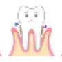 Gum treatment