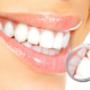 Smile teeth