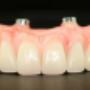 Dentures Plus